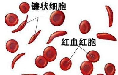 人體茄子视频破解版廠家介紹檢測微量元素的儀器